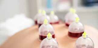 Hijama