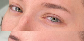 Lash lift i Brow lift: vodic za savršene trepavice i oblikovane obrve