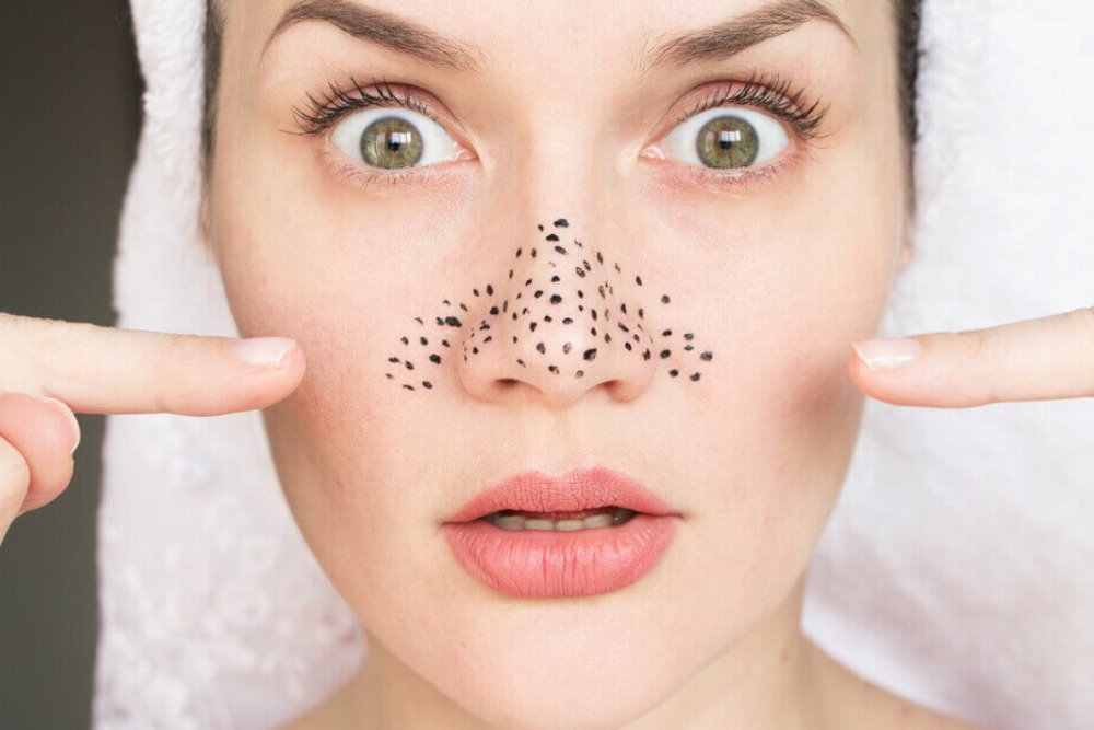 Profesionalni tretmani lica